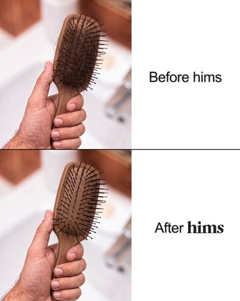 hims image Facebook ad: Time to see the difference! (4 of 4)